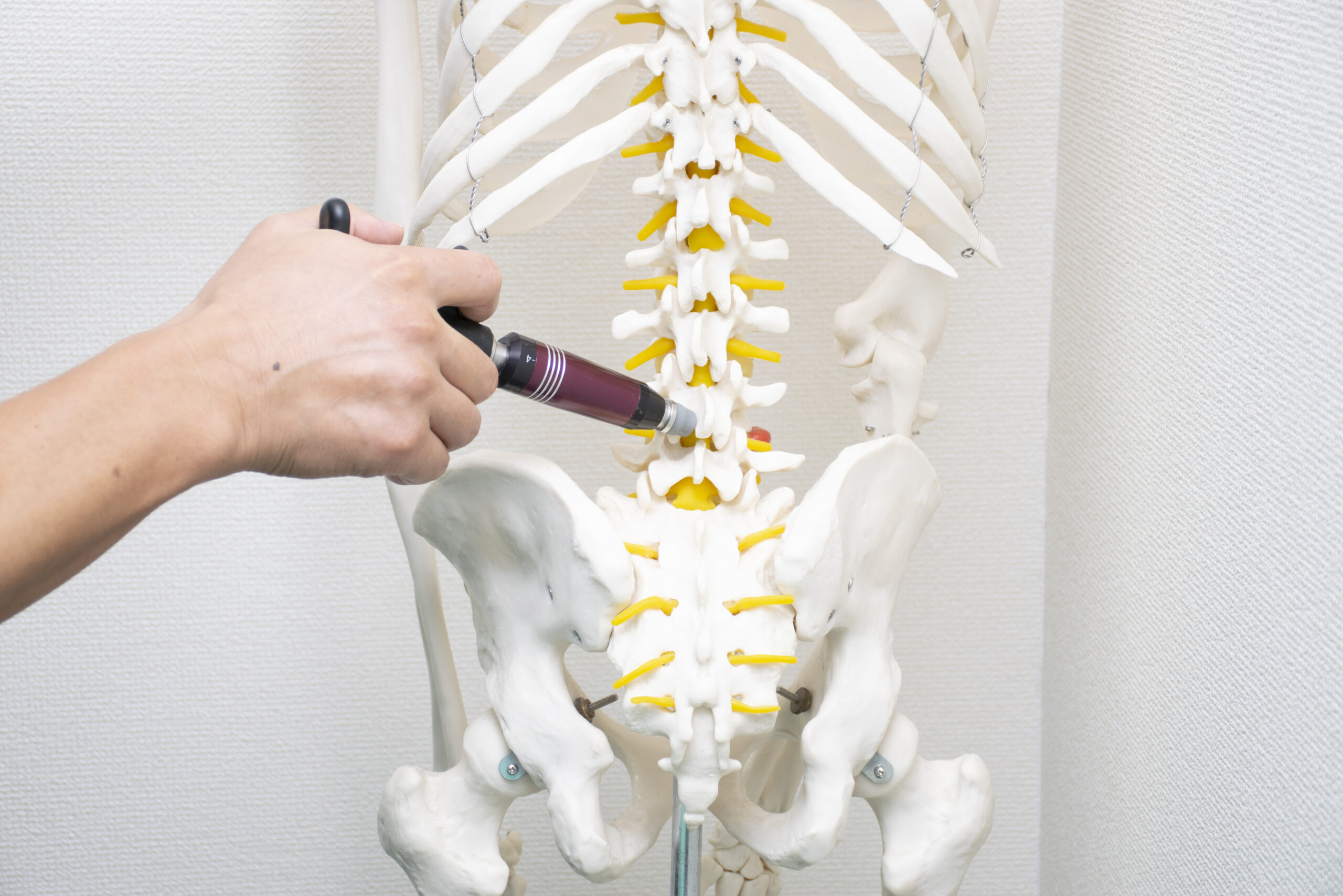 アクティベータ・メソッド機器の画像